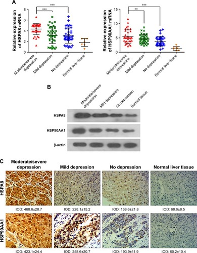 Figure 2 Levels of mRNAs encoding HSP90AA1 or HSPA8 based on qRT-PCR (A). Levels of HSP90AA1 and HSPA8 protein based on Western blotting (B). Levels of HSP90AA1 and HSPA8 protein based on immunohistochemistry (magnification, 200×) (C).