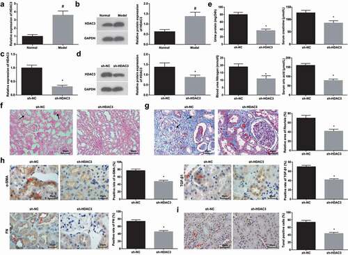 Figure 2. Suppressed HDAC3 relieves HN-induced RIF. (a/b). RT-qPCR and Western blot assay detected HDAC3 expression of HN rats; (c/d). RT-qPCR and Western blot assay detected HDAC3 expression of HN rats after down-regulation of HDAC3; (e). 24 h urine protein, Scr, BUN and UA in serum of HN rats after down-regulation of HDAC3; (f). H&E staining analyzed pathological damages of renal tissues of HN rats after down-regulation of HDAC3; (g). Masson staining analyzed the degree of fibrosis and RIF index of HN rats after down-regulation of HDAC3; (h). α-SMA, TGF-β1 and FN contents in renal tissues of HN rats after down-regulation of HDAC3; (i). TUNEL staining detected renal cell apoptosis of HN rats after down-regulation of HDAC3. Data were expressed as mean ± standard deviation. The t-test was used for comparison between two groups. # P < 0.05 compared with the normal group; * P < 0.05 compared with the sh-NC group.