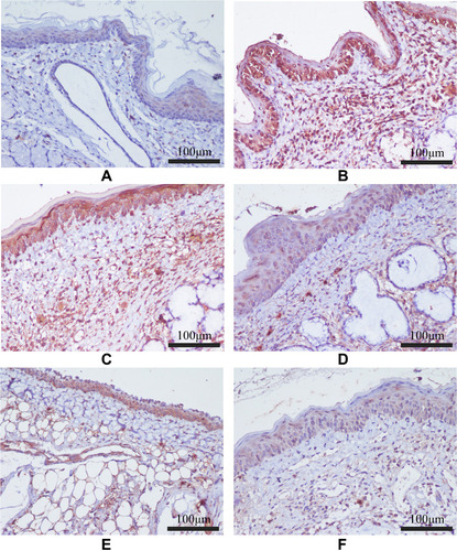 Figure 13 The effect of FFZJF aerosol on the NF-κB P65 protein expression in rat’s pharyngeal mucosal tissues by immunohistochemistry (400×). NF-κB P65 is stained brown. (A) Control group; (B) Model group; (C) FFZJF-L group; (D) FFZJF-M group; (E) FFZJF-H group; (F) AS group.