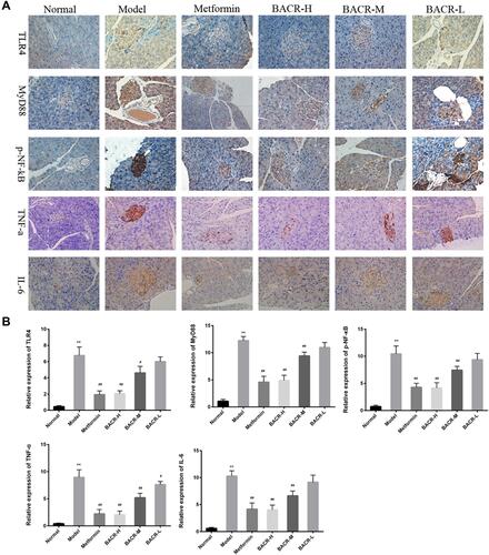 Figure 7 Immunohistochemical (IHC) staining (400×) showed expression of TLR4, MyD88, p-NF-κB, TNF-α, and IL-6 in pancreas tissues. The positive rate was analyzed with Image-Pro Plus. Metformin group: 320mg/kg; BACR-H group: 120mg/kg; BACR–M group: 60mg/kg; BACR-Lgroup: 30mg/kg. Data are presented as the mean ± SD (n = 10). **P< 0.01 vs Normal control group. #P < 0.05 or ##P<0.01 vs Model control group.