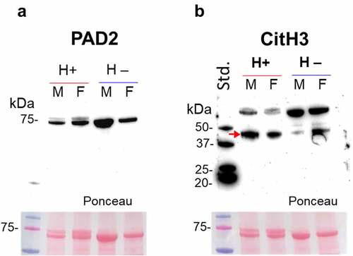 Figure 4. PAD-homologue/ADI assessment and evidence for histone H3 citrullination in shore crabs. a) Using anti-human PAD2 antibody on crab haemolymph, a band at the expected ~75 kDa was observed in both parasitised (males/females) and control (male/female) groups. b) Evidence for histone H3 citrullination, albeit bands are at a slightly higher kDa level than expected. Some differences are observed in the lower band in the parasitised (H+) group (increased signal, indicated by a red arrow) and accompanied by a decrease in the higher band (higher band in the control; H –). Haemolymph. Std., protein standards (ladder); M, male; F, female.