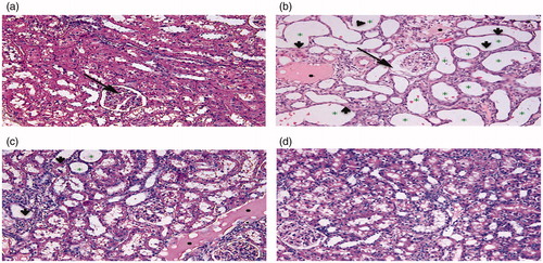 Figure 3. (a) Renal histology from sham operated rat at 2 weeks post-surgery. A glomerulus is marked with an arrow. (b) Histology from rat subjected to 120 min IRI, 2 weeks post-surgery. Note marked tubular dilation (green asterisk) with epithelial thinning and breaks (arrowheads). Also, present are hyaline casts (black dots). A glomeruli with an increased Bowman’s space is marked with an arrow. (c) Histology from rat subjected to 120 min IRI 6 weeks post-surgery. Hyaline casts are noted, but tubular dilation and epithelial thinning are less pronounced. (d) Renal histology from rat subjected to 120 min IRI, 6 weeks post-surgery. The animals were treated with intra-arterial stem-cell based therapy. Histological damage is less marked than with saline treated animals.