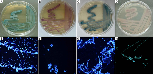 Figure 1 Identification of the Candida isolates (A–D) are colony morphology of Candida albicans, Candida glabrata, Candida tropicalis and Candida krusei on chromogenic medium (CHROMagar),respectively; (E–H) are morphology of Candida albicans,Candida glabrata, Candida tropicalis and Candida krusei calcofluor white staining under microscope, respectively (×400).