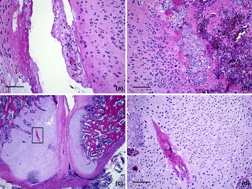 Figure 9.  Osteochondrosis in vertebral cartilage. 9a: A higher magnification of Figure 8d shows a tag of degenerated and necrotic cartilage in the expanded articular space of the thoracic vertebra. Necrotic cartilage also is on the left side of this space. Bar = 100 µm. HE. 9b: Chondrocytes are disorganized and necrotic. Osteomyelitis is in bone beneath the articular surface of the vertebra. Bar = 100 µm. HE. 9c: A higher magnification of Figure 8a (* below the box) and shows the distorted articular surface and prominent persisting cartilage. The area within the box is shown at higher magnification in 8d. Bar = 200 µm. HE. 8d: An area of degeneration of cartilage is characterized by loss of cells and accumulation of eosinophilic material. Chondrocytes are variable in size and arranged in an irregular pattern. Bar = 100 µm. HE.