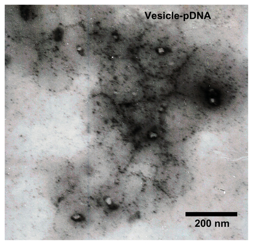 Figure S2 Transmission electron microscopy image of the vesicle/plasmid DNA (pDNA) polyplex.