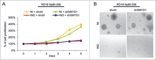 Figure 3. SMYD1 is not involved in the miR-206-mediated inhibition of proliferation and soft agar growth in ERMS cells. (A) MTT analysis of RD18 NpBI-206 cells infected with a constitutive control (shctrl) or SMYD1-directed (shSMYD1) shRNA, grown in the absence of doxycycline (miR-206 not induced, NI) or after doxycycline administration (miR-206 induced, IND) for the indicated days. The number of cells at day 0 was set at 100%. (B) Representative image of a soft agar growth assay of the cells described in (A).