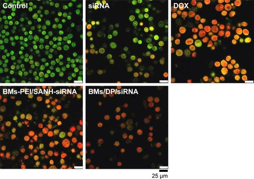 Figure 7 AO/EB-stained images of HeLa cells after culturing with fresh medium (control group), siRNA, DOX, BMs-PEI/SANH-siRNA, and BMs/DP/siRNA for 48 h.Abbreviations: AO, acridine orange; BMs, bacterial magnetosomes; DOX, doxorubicin; DP, DOX–PEI; EB, ethidium bromide; PEI, polyethyleneimine; SANH, succinimidyl 6-hydrazinonicotinate acetone hydrazine.