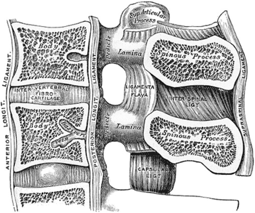 Figure 6. A sagittal view of the spinal canal exposing the structures that delineate the spinal canal and in the degenerative process can impinge on the dural sac and nerve roots. A drawing from 20th US edition of Gray`s Anatomy of the Human Body. This edition was originally published in 1918 and is now in the public domain.
