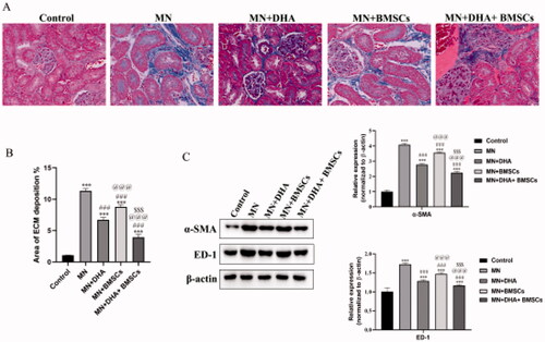 Figure 4. Effects of combination therapy with DHA and BMSCs on renal fibrosis in MN mice. (A) Representative sections of kidney stained with Masson’s trichrome (original magnification ×400). (B) Area of ECM deposition in the kidney. (C) Western blot of α-SMA and ED-1 expression in the kidney. Values are expressed as the mean ± SD, n = 5 per group. ***p < .001 versus control group; ###p < .001 versus MN model group; @@@p < .001 versus MN + DHA group; $$$p < .001 versus MN + BMSCs group.