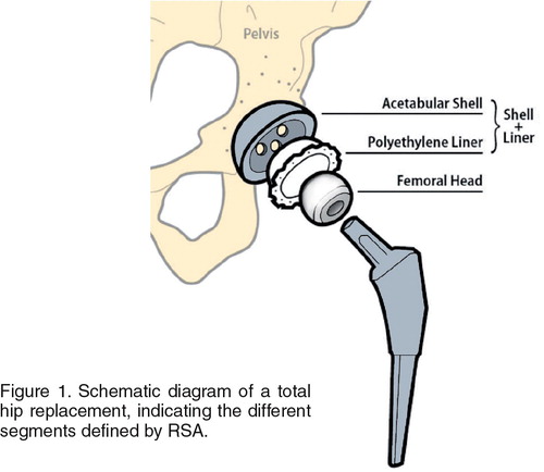 Figure 1. Schematic diagram of a total hip replacement, indicating the different segments defined by RSA.