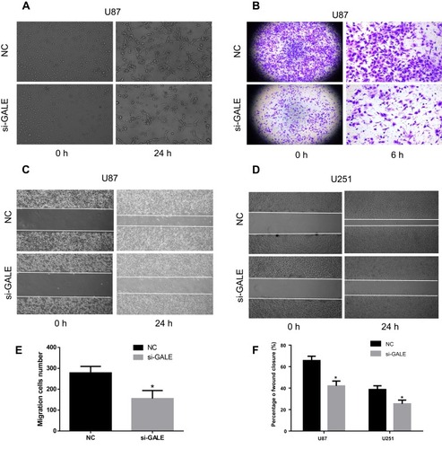 Figure 3 Silencing GALE reduces the migration of glioma cells. (A) A 24-h VM formation assay was performed in U87 cells. (B, E) U87 cells were transfected with NC or si-GALE. Cell migration was assessed 6 h after culture by transwell analysis. (C, D, F) U87 and U251 cells were transfected with NC or si-GALE and analyzed for wound healing during the 24-h recovery period. *P < 0.05.