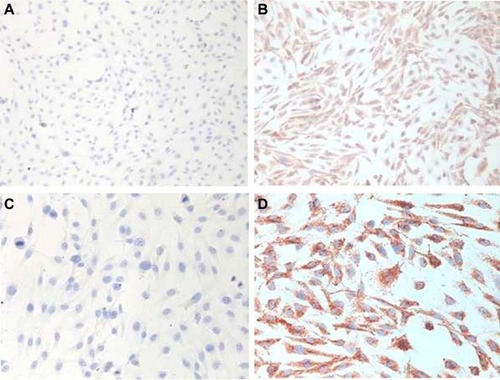 Figure 1 Factor VIII-related antigen staining. Representative immunohistochemistry images of lung cells (A, C) and HUVECs (B, D). Original magnification, 100× (A, B), 200× (C, D).Abbreviation: HUVECs, human umbilical vein endothelial cells.