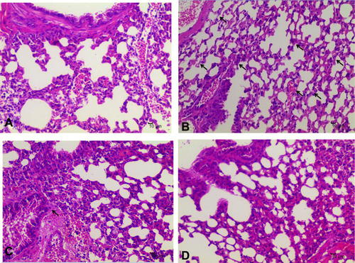 Figure 9 Effect of geraniol on lung tissue of MRSA-infected mice. (A): control group, (B): model group, (C): positive control group, (D): experimental group.