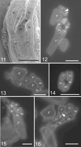 Figs 11–16. SEM and fluorescence microscopy of Pileidinium ciceropse, gen. et sp. nov. Fig. 11. SEM of sulcal plates. Fig. 12. Fluorescence microscopy of part of the epitheca, sulcus and 1′′′ plate. Arrow indicates a circular pore in the epitheca. Fig. 13. Fluorescence microscopy of part of the epitheca and cingulum. Fig. 14. Fluorescence microscopy of sulcal plates except ls. Fig. 15. Fluorescence microscopy of part of the epitheca, cingulum and 3′′′ plate. Fig. 16. Fluorescence microscopy of part of the epitheca and cingulum. Arrow indicates a circular pore.