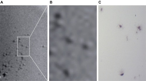 Figure 5 High resolution T2*-weighted images depicting individual PANC-1 cell positions after uptake of the iron oxide core gold-shell nanoparticles (A and B); corresponding ×20 microscopy image (C).