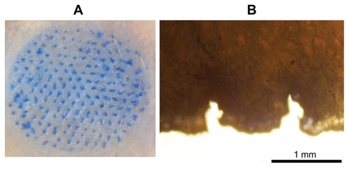 Figure 7 Skin penetration by microneedles: (A) pigskin dyed with trypan blue after microneedle patch removed; (B) micrograph of tissue slice of the pigskin.