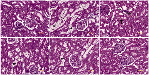 Figure 1. Light microscopy of kidney tissues is seen in different groups. (A) In controls, normal kidney architecture is observed. (B) Group D, transparent tubules (*) are detected. (C) Group D, dilatation in distal tubules (*) and epithelial desquamation into the lumen of tubules (arrow) are seen. (D) Group D + PI, transparent tubules (*) are exhibited. (E) Group D + PII, transparent tubules (*) are shown. (F) Group P, normal kidney architecture is observed. Kidney cross sections were stained with Masson’s Trichome.