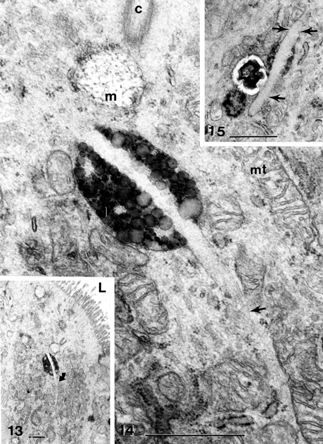 Figures 13–15 Apical region of cholecystitic gallbladder epithelial cell (Figure 13) containing normal mucous vesicles and an heterogeneous lipidic deposit is bisected by a long, curved (Figures 13 and 14) and a thick (Figure 15) needle-like deposit (curved arrow and straight arrows) amidst mitochondria clusters, smooth and rough ER pieces C, centriolar basal body; L, lumen; m, mucous vesicle; mt, mitochondria. All scale bars equal 1 μm.