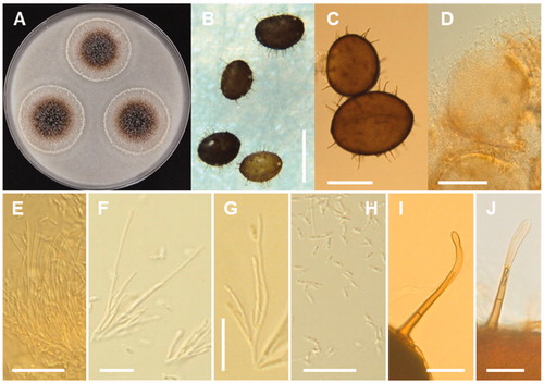 Figure 6. Morphology of Chaetomella raphigera CNUFC-GHD05-1. A, Colonies in corn meal agar; B–D, Pycnidia; E–G, Conidiophores and conidiogenous cells; H, Conidia; I, J, Setae on pycnidia (Scale bars: B = 200 μm, C = 100 μm, D = 50 μm, E–J = 20 μm).