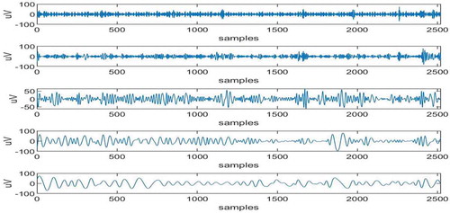 Figure 3. IMFs (1 to 5) obtained by applying EEMD