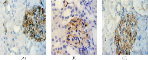 Figure 4. Glomerular capillary staining in tissue samples. (×400). (A) Control group at day 7. The glomerular capillary of control group kidneys was prominent. (B) Model group at day 7. The staining of glomerular capillary was markedly decreased. (C) PGE1 group at day 7. The positive staining was slightly decreased.