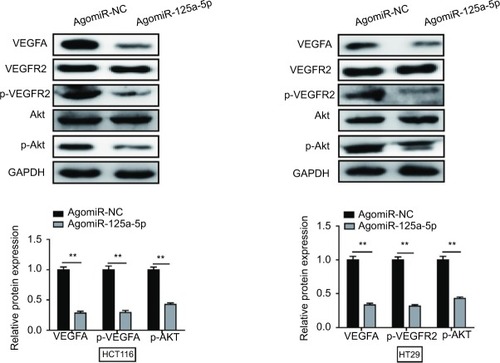 Figure 7 miR-125a-5p inhibited CRC progression via VEGFA/VEGFR2 signaling pathway. miR-125a-5p reduced the expression of VEGFA, p-VEGFR2, and p-Akt. GAPDH was used as an internal control. Each experiment was performed three times. Data are shown as mean±SD. **P<0.01.Abbreviation: CRC, colorectal cancer.