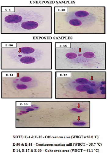 Figure 4. Micro nuclei assay images for both unexposed and exposed workers using light microscope.