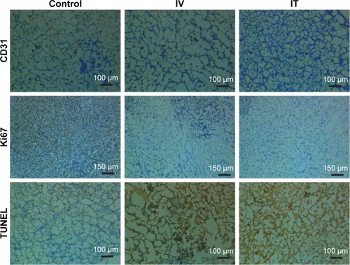 Figure 8 Immunohistochemical staining for CD31, Ki67, and TUNEL analysis of mouse after treatment with saline (control) or SP-MoS2 nanosheets (IV or IT injection).Abbreviations: IV, intravenous; IT, intratumoral; SP-MoS2, soybean phospholipid-encapsulated MoS2; TUNEL, terminal deoxynucleotidyl transferase dUTP nick end labeling.