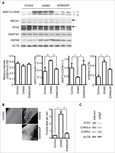Figure 6. CAR3 suppresses endocytosis via a macroautophagy-mediated pathway. (A) Gastrocnemius from mice was homogenized in lysis buffer containing 1% NP-40, subject to SDS-PAGE and immunoblot analysis with the indicated antibody. Densitometric quantification of the indicated proteins over ACTB using ImageJ (right panel). (B) Gastrocnemius fixed, frozen sectioned, and permeabilized. After being blocked with 20% goat serum, the sections were incubated with anti-MAP1LC3A/B antibody and the appropriate Alexa Fluor 488-conjugated secondary antibody. After washing with PBS, the sections were examined with a confocal microscope and images were captured (left panel). Scale bar: 20 µm. MAP1LC3A/B-positive puncta were counted, and at least 50 cells were quantified. Puncta per cell are shown as mean ± SEM of 3 independent experiments (right panel). (C) C2C12 cells were transiently transfected with siScram or siAtg7 using Lipofectamine 3000. Forty-eight h later, the cells were either lysed and subjected to SDS-PAGE and immunoblot analysis with CHRN antibody (total CHRN, CHRN-t), or labeled with biotin-CHRN antibody (mAb210) and after 2 h the cells were washed with acidic buffer, lysed and analyzed by SDS-PAGE and immunblot analysis with streptavidin-HRP for endocytosed CHRN (CHRN-e). *p < 0.05, compared with the control group. Data are mean ± SEM of 3 independent experiments.