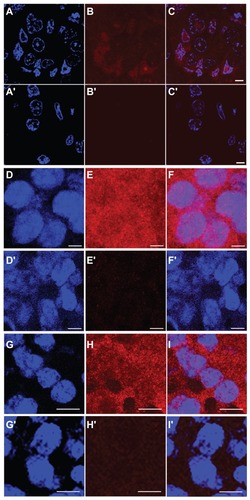 Figure 5 Immunofluorescence analysis of in vivo subcellular localization of MNT 3 hours after intravenous injection in mice. (A–C) 2–3 μm tumor section (63× objective lens) from Balb/c ByJIco-nu/nu mouse bearing human A431 epidermoid carcinoma 3 hours after intravenous injection of chlorin e6-DTox-HMPNLS- EGF, (A′–C′) the same, but from the control mouse that was injected with saline. (D–F) 10 μm tumor section (63× objective lens) from C57 black/6J mice bearing murine B16-F1 melanoma injected with DTox-HMP-NLS-αMSH, (D′–F′) the same, but from the control mouse that was injected with saline. (G–I) 10 μm tumor section (63× objective lens) from DBA/2 mice bearing murine Cloudman melanoma S91 injected with DTox-HMP-NLS-αMSH, (G′–I′) the same, but from the control mouse that was injected with saline. (A), (A′), (D), (D′), (G), (G′) DAPI staining of cell nuclei (blue); (B), (B′), (E), (E′), (H), (H′) Alexa Fluor 555 staining for MNT (red); (C), (C′), (F), (F′), (I), (I′) overlay of cell nuclei fluorescence (blue) and MNT fluorescence (red). Scale bar 5 μm for (A–F) and for (A′–F′); scale bar 10 μm for (G–I) and for (G′–I′).Abbreviations: MNT, modular nanotransporter; DTox, translocation domain of diphtheria toxin; HMP, the Escherichia coli hemoglobin-like protein; NLS, nuclear localization sequence; EGF, epidermal growth factor; αMSH, α-melanocyte stimulating hormone; SEM, standard error of mean; DAPI, 4′,6-diamidino-2-phenylindole.