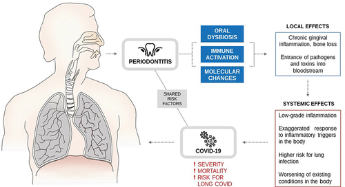 Figure 1. The potential link between periodontitis and COVID-19. Oral dysbiosis, activation of the immune system, and molecular changes promoted by periodontal bacteria cause local inflammation and tissue destruction. This facilitates the entrance of pathogens and toxins into the bloodstream, leading to systemic consequences that increase the risk of infection in other organs. In patients with COVID-19, periodontitis can increase the risk of complications and death.
