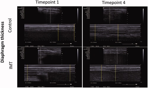 Figure 4. The M-mode images of the diaphragm thickening fraction in the CTL group and the IMT group at Timepoint 1 and Timepoint 4.