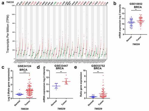 Figure 1. Transcriptional profiles of TMED9 in BRCA and normal breast samples. (a) List of 33 cancer types (TCGA). Transcriptional patterns based on the (b) GSE15852, (c) GSE24124, (d) GSE33447, and (e) GSE53752 cohort. TCGA, the cancer genome atlas. *P < 0.05, **P < 0.01, ***P < 0.001