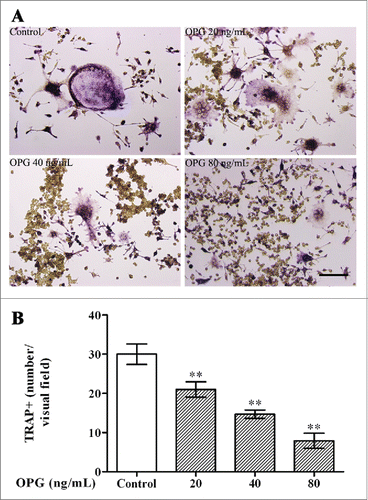 Figure 1. Inhibitory effects of OPG on osteoclast differentiation. RAW264.7 cells were suspended in α-MEM containing 10% FBS, 30 ng/mL RANKL and 25 ng/mL M-CSF. After 48 h of incubation, the medium was changed to serum-free α-MEM containing the 2 cytokines the cells were cultured for an additional 24 h. Next, OPG (0, 20, 40 and 80 ng/mL) was added and incubated for 24 h. (A) Cells were fixed and stained for TRAP (Magnification ×200, Scale bar = 50 μm) (B) TRAP-positive multinucleated cells (TRAP+) were observed by inverted phase contrast microscopy and counted (Magnification ×100). The results are expressed as the mean ± SD. **p < 0.01 and *p < 0.05 versus control.