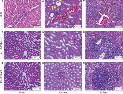 Figure 10 Liver, kidney and spleen histology. Hematoxylin and eosin stains of liver (1–3), kidney (4–6), and spleen (7–9) tissues of Wistar rats injected with phosphate buffered saline, quantum dots (QDs), and anti-HER2ab-QDs. One-headed arrow indicates tissue damage (yellow), mineralization (green), and protein fluid (black).