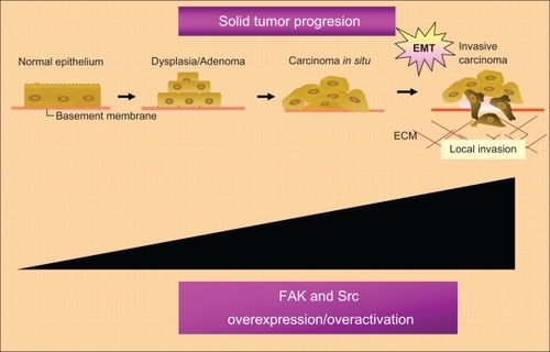 Figure 3 Role of the FAK-Src complex in the malignant progression of solid tumors.