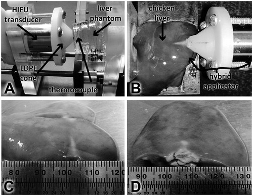 Figure 10. Experimental set-up for induced temperature measurement inside the liver phantom and ex vivo experimentation. (A) Hybrid applicator set-up for temperature measurement in the liver phantom. (B) Hybrid applicator set up for ex vivo experimentation. (C) HIFU effects in chicken liver at 10 W. (D) HIFU effects in chicken liver at 20 W.
