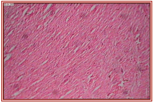 Figure 1.  Normal healthy control group (i.e. group I) rat heart section, showing normal cardiac muscle bundles (×10).