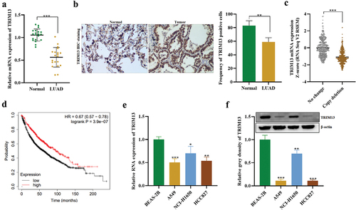 Figure 1. Downregulation of TRIM13 in LUAD tissues.