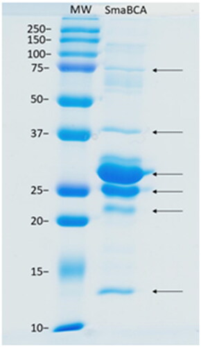 Figure 4. SDS-PAGE of β-CA of S. mansoni (SmaBCA) showing six polypeptide bands confirmed to represent SmaBCA by mass-spectrometry (data not shown). Right lane: The most intense bands of 25 and 29 kDa are the main forms of the expressed protein, and the additional polypeptides either are degraded forms (13 and 22 kDa) or oligomers (38 and 75 kDa). Left lane: Standard molecular weight (MW) markers in kDa.