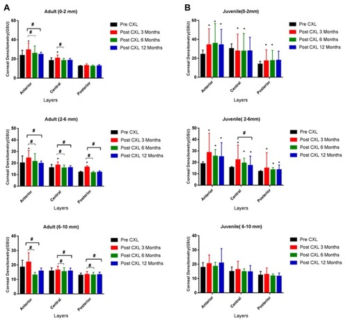 Figure 1 Corneal densitometry diversity at 3, 6 and 12 months post treatment for both groups. (A) Adult and (B) Juvenile in the different corneal zones and layers (* significant from pre-treatment and # represent significant from 3 months post treatment at level P<0.05).