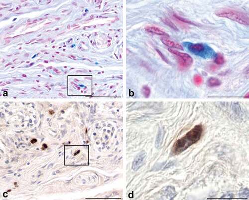 Figure 2. Mast cells in connective tissue septa of CBs can be identified with alcian blue/nuclear fast red stain (Panels a, b) or an antibody against mast cell tryptase (Panels c, d). Note the distribution, morphology, and size of cells stained with alcian blue is similar to the distribution, morphology, and size of the cells stained with the rabbit polyclonal antibody generated against mast cell tryptase. The cell located in the box of panel a and enlarged in panel B is similar to the cell located in the box of panel c that is enlarged in panel d. The mast cells indicated in this figure possess the same distribution, morphology and size as the PrPC-expressing cells shown in panels c and d of figure 1. Scale bars: Panels a, c = 50 µm; Panels b, d = 10 µm.