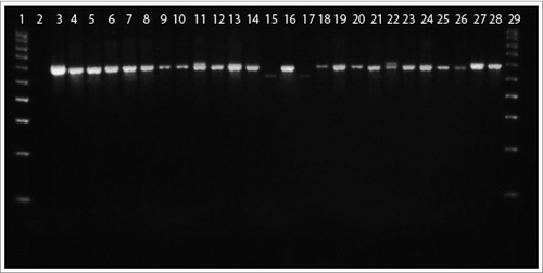 Figure 6. 16S rRNA PCR of blood L-form cultures (L) grown during the second phase/week of cultivation in semisolid agar. Legend: 1, DNA ladder 100 bp; 2,Water; 3, L1; 4, L6; 5, L14 6, L47; 7, L58; 8, L60; 9, L62; 10, L64; 11, L65; 12, L70; 13, L96; 14, L16; 15, L19; 16, L20; 17, L23; 18, L25; 19, L26; 20, L34; 21, L37; 22, L41; 23, L52; 24, L53; 25, L91; 26, L93; 27, M. tuberculosis H37Rv 10ˆ-5; 28, M. tuberculosis H37Rv 10ˆ-3; 29, DNA ladder 100 bp.