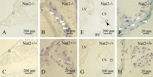 Figure 3.  Nat2 expression in adult heart. Nat2 expression detected by x-gal staining in sections through the short axis of 8-week-old adult Nat2−/ −  and control Nat2+/ +  mouse hearts at the level of the tricuspid valve. (A–D) Right atrium; (E–H) coronary sinus (both left and right ventricular myocardium visible in (E). Site of Nat2 expression are indicated by arrowheads in frame (F). All samples were counterstained with haematoxylin. Scale bars: (A, C, E, G) 200 µm; (B, D, F, H) 20 µm. LV, left ventricle; RV, right ventricle; CS, coronary sinus. Colour available online.