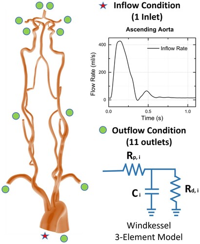 Figure 2. Specific boundary conditions for each patient model. Pulsatile inflow (reproduced from Olufsen et al., Citation2000) was given at the aorta, and Windkessel 3-element outlet conditions were used for a total of eleven outlet boundaries.