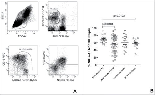 Figure 4. Co-expression of NKG2A, NKp30 and NKp46 in NK-cells from HCC patients and controls. (A) Strategy for the flow cytometric analysis of receptor co-expression in NK-cells; (B) Frequency of NK-cells co-expressing NKG2A, NKp30 and NKp46 in HCC patients' clusters and in controls. Significance levels are reported.