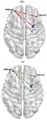 Figure 5 A brain MEG functional connectivity analysis based on seed regions of the orbitofrontal cortex (OFC) showed that, compared to HC group, brain regions involved in the functional connectivity network of OFC in MD group included: the functional connectivity between the left superior frontal gyrus (orbital part) and the right inferior frontal gyrus (orbital part), right amygdale and right parahippocampal gyrus.