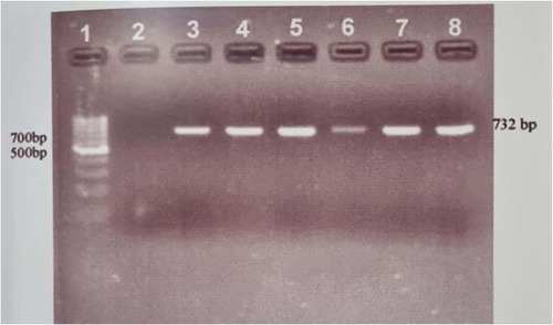 Figure 1 Gel Electrophoresis of PCR amplification of Van A gene. Lane 1 indicates DNA Ladder (1 Kbp), Lane 2: Blank (Negative Control), Lane 3: Positive Control, Lane 4,5,6,7,8 VRE clinical isolate positive with van A gene.
