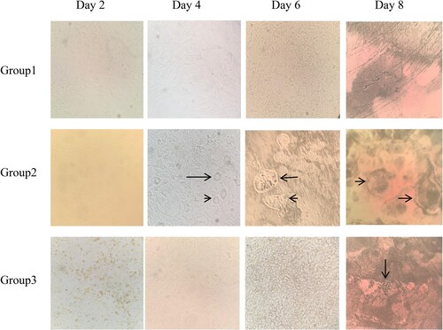 Figure 2. Photograph of different stages of differentiation of 3T3-L1 pre-adipocytes to mature adipocytes. Note: Differentiation and oil-red-o staining of 3T3L1 cells treated with total LOPs were carried out using HiDiff™ 3T3-L1 Differentiation kit (CCK011), Himedia, Mumbai, India; according to manual protocol. Cells were cultured in DMEM, high glucose medium supplemented with 10% FBS. The cells were maintained at 37°C and 5% atmospheric CO2. On Day 0 the cells were sub-cultured and after reaching 70-80% confluency, were treated with differentiation medium 1 on Day 2 and differentiation Medium 2 on Day 4. Complete differentiation was achieved on Day 8 and the lipid droplets were stained using the Oil-red-O staining method. Cells were viewed under Moticam Pro 205 A microscope with 400× magnification. Group 1 3T3-L1 cells are grown only in DMEM media without differentiation media and total LOPs. Group 2 3T3-L1 cells are grown with differentiation media but without treatment with total LOPs and Group 3 3T3-L1 cells are grown with differentiation media and total LOPs of concentration (100 µg/ml).