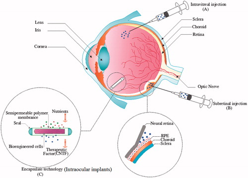 Figure 3. Schematic graphic of the routes of ocular CNTF delivery. (A) Intravitreal injection, (B) Subretinal injection, (C) encapsulated cell technology implantation.